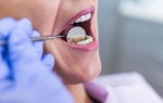 Сенсационное открытие ученых — здоровье мозга зависит от здоровья зубов