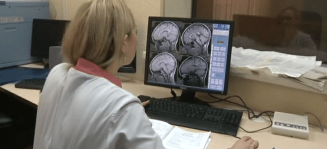 Все об аневризме головного мозга: причины, диагностика, лечение, профилактика, последствия